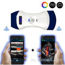 OEM Wifi Convex &amp; Linear Color Ultraschallsonde